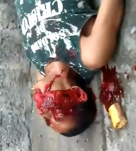 Blood Pours like a Waterfall after Shot in the Mouth