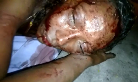 Woman Beaten During Sexual Assault