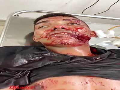 TWO Smiles IN A SINGLE FACE