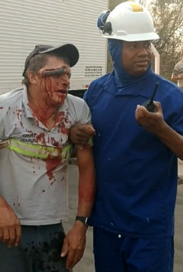 Man's Eye Impaled by the Iron Rod