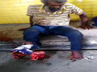 Foot Destroyed and He Doesn't Give a Shit!