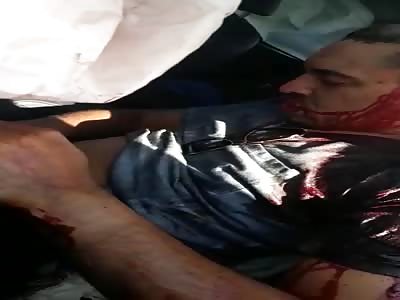 Is There any Blood left in his Body?