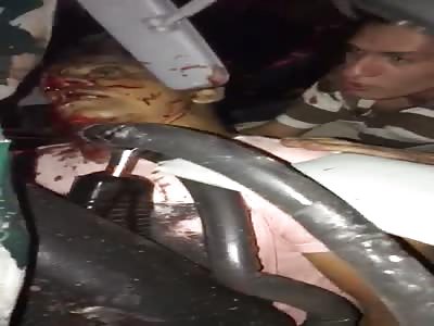 Plastic Surgery Won't Help That