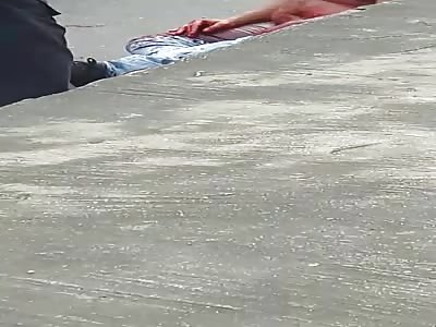 MAN WITH SERIOUS WOUNDS