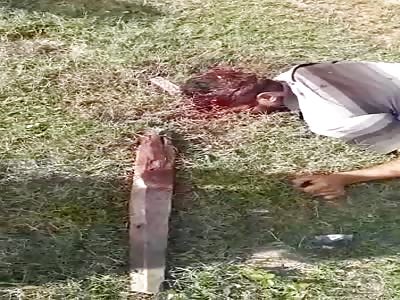 Dudes Head Beaten in with a Stick