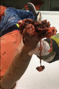 BRUTAL: Grenade Explodes in Protestor's Hand