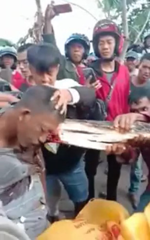Piece of Tree Embedded In Bloody Man's Shoulder