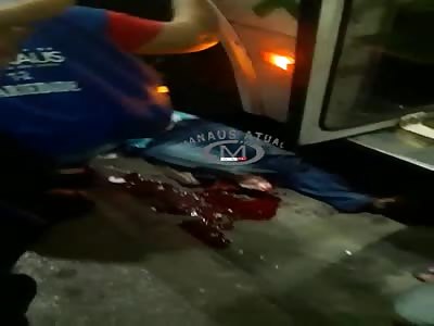 WOMAN LOSES THE FOOT IN ACCIDENT