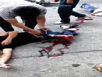 CONSEQUENCES OF AN ACCIDENT HORRIBLE