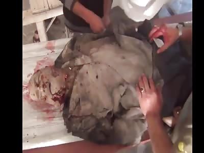 BUT WHAT HAPPENED TO HIS FACE?