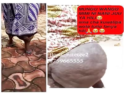 OMG: woman with a bizarre illness