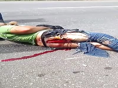 Man's ass Ripped WIDE Open after Motorcycle Accident