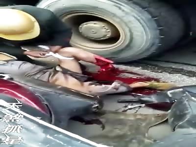 WTF: LEG DESTROYED IN ACCIDENT