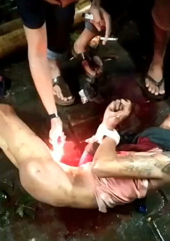 INSANE TORTURE: Villagers Burnt His Cock and Balls