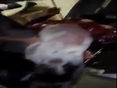 MAN WITH SERIOUS WOUNDS