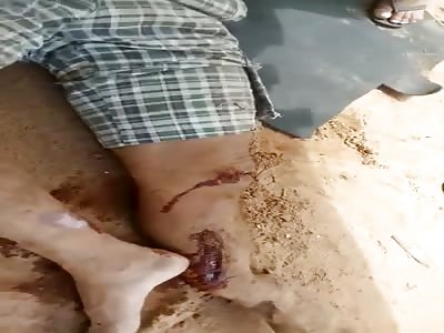 MAN WITH SERIOUS WOUNDS