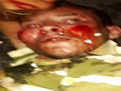 THIEF RECEIVING PUNISHMENT