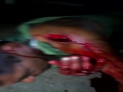 man wounded to death by favela rivals