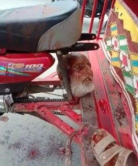 Motorbiker Decapitated By A Bus.