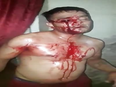  Fucking SAVAGES Rip His Eyeball Out