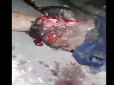 man with a shattered head