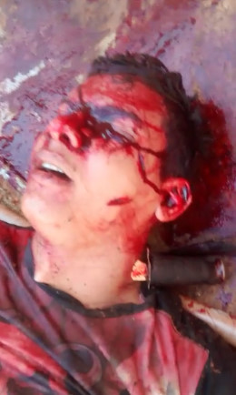 You Got Something on Your Neck Bro!