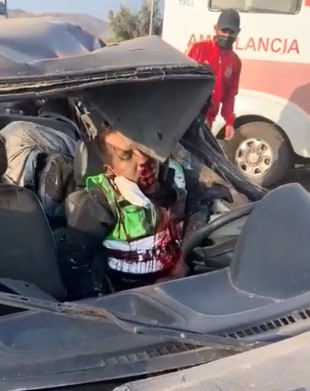 DAMN! You Can See into the Bone