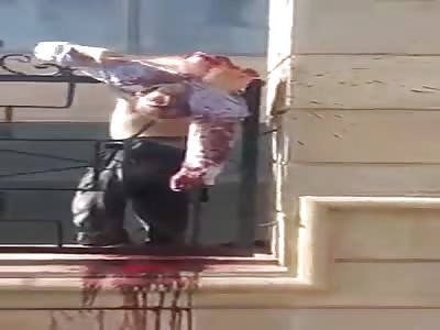 Body Split in Half Hanging from the Fence