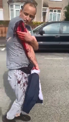 DAMN! Now THAT'S Machete Damage