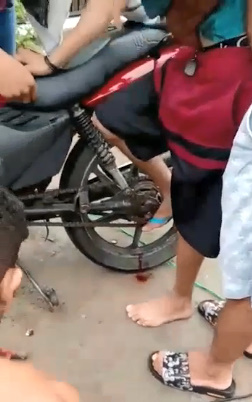 Big Toe Crushed in Motorcycle Accident Had to Be Amputated