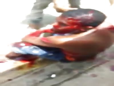 Seriously injured man with machete