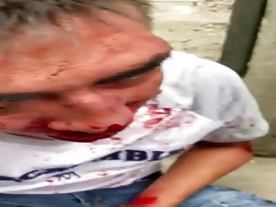 THIEF RECEIVING PUNISHMENT