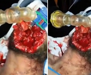  Man With Face Blown Off by Shotgun After Killed His Girlfriend