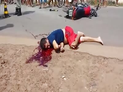 Biker on Road with Gash in Head and Destroyed Knee Cap