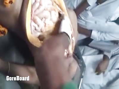 Autopsy Pregnant Girl and Her Unborn Fetus