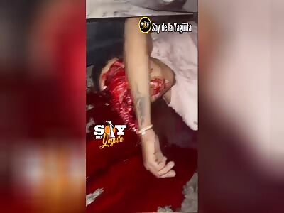 Dude's Head Split The Fuck Open