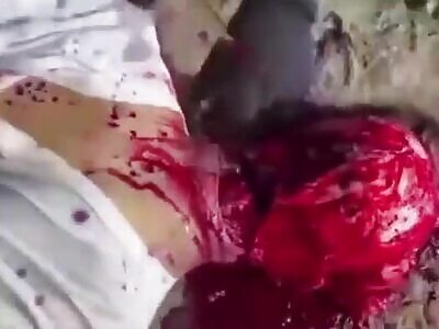 Brutal : Man's Face Skinned While He's Alive