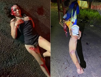 Couple Lost Battle With A Parked Truck