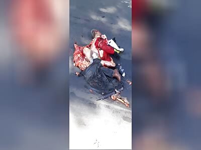 brazilian man turned into a pancake