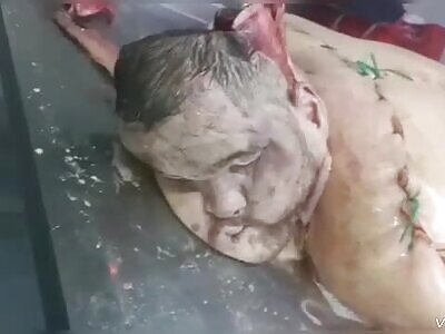 Autopsy of two brothers killed by drug gang in Colombia 