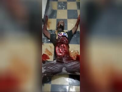 Put My Intestines Back In Please