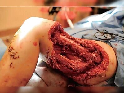 Death, Illness, Injury, Healing #16 (compilation)