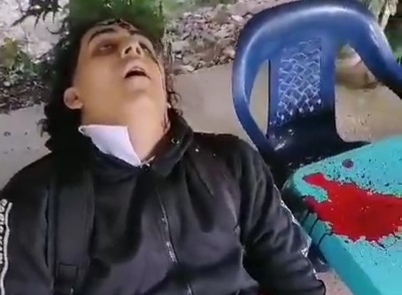 Young Gangster Executed by Sicario in Medellín, Colombia 