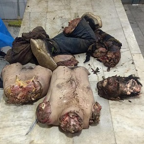 Dalit Man Chopped Into Pieces For Having Affair with Muslim Woman