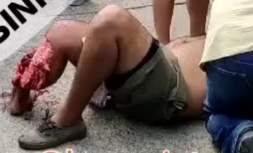 Motorcyclist fucked up his leg 