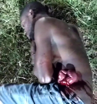 The man's intestines came out after being stabbed