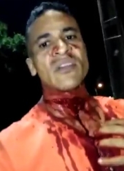 A man with a cut throat is headed to the hospital