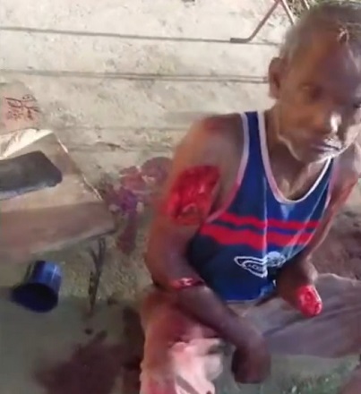 Woman Chopped Off Man's Hand Defending Female Relative