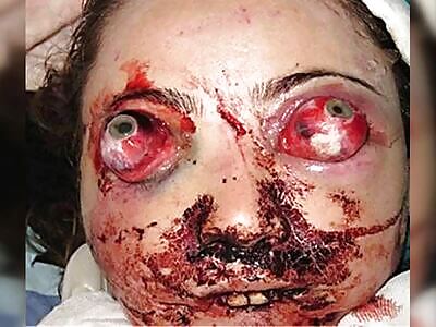 Death, Illness, Injury, Healing #17 (compilation)