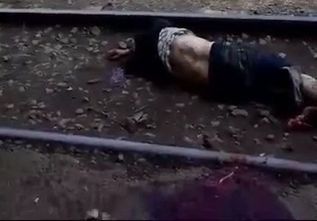  man was hit by a tram - his leg was cut off